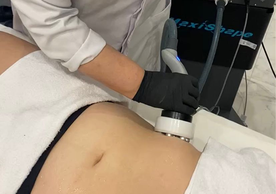 Tecnologia de ponta. Criofrequência. Combinação de frio intenso com radiofrequência que promove a contração da pele, redução de medidas e estimulação de colágeno. Trata face, corpo e região íntima.. Pele mais firme; Redução de medidas; Estímulo de colágeno;.